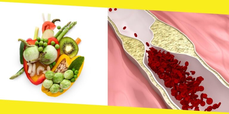 6 Best Foods to Keep You Safe From Clogged Arteries Naturally