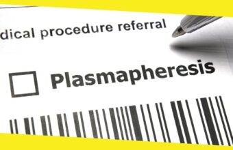 Do You Qualify For Plasmapheresis?