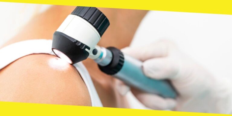 Why You Should Choose Mohs Surgery as Your Skin Cancer Treatment