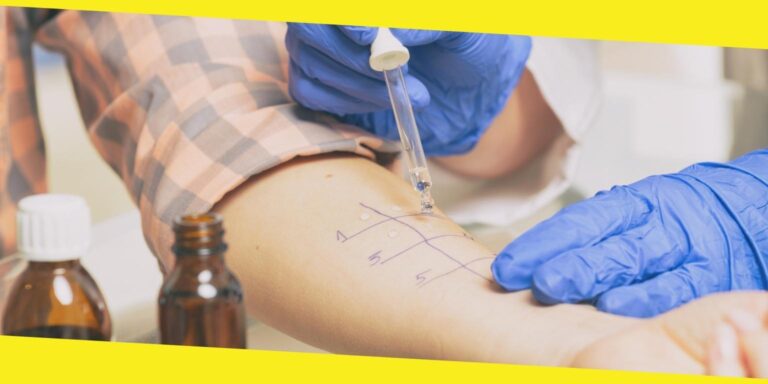The Importance of Testing Your Allergies