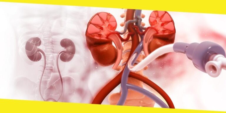 What You Need to Know About Complex Vascular Diseases