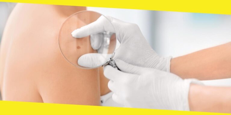 Dermatologists and What They Do