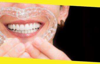 5 Favorite Tips on Handling Invisible Aligners