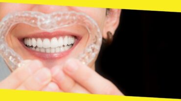 5 Favorite Tips on Handling Invisible Aligners