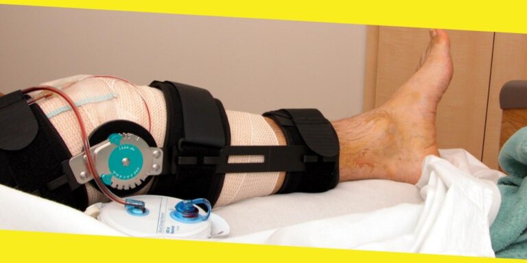 When Should You Consider Revision Knee Replacement Surgery?