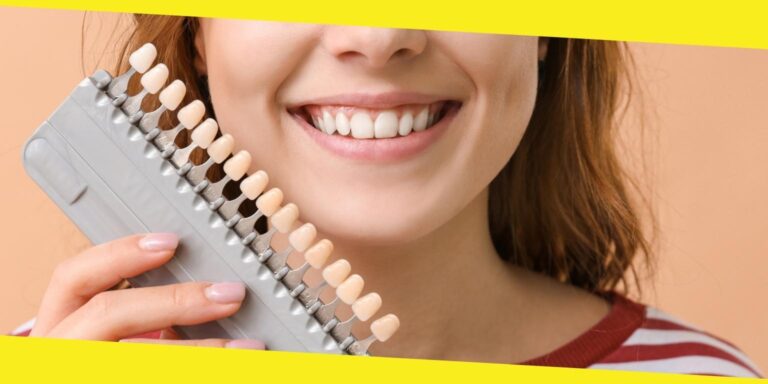 Are Porcelain Veneers Strong?