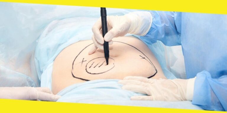 What You Should Know If You Are Thinking About Undergoing A Hysterectomy