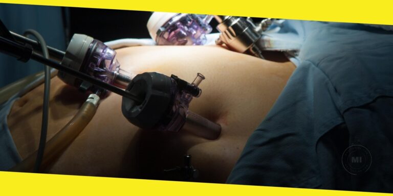 Things to Know Before, During, and After a Gastric Bypass