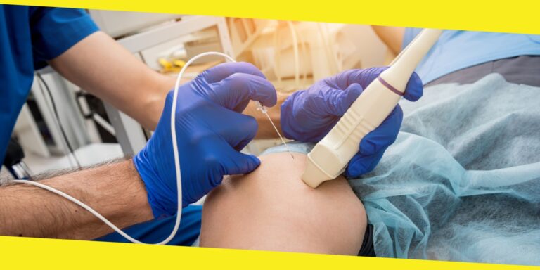 All You Need to Know about Radiofrequency Ablation