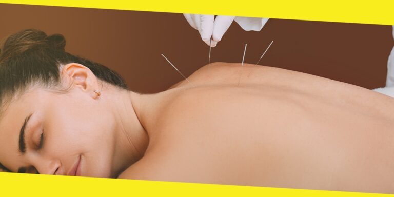 6 Surprising Benefits of Acupuncture for Your Health