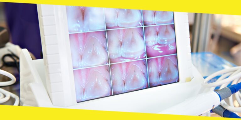 The Benefits of Dental Monitoring