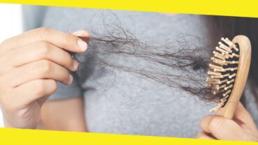 Common Causes of Hair Loss