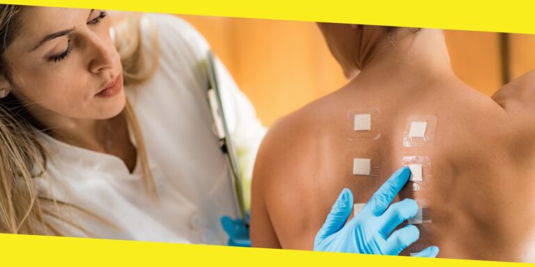 What to Expect Before, During And After Skin Allergy Testing
