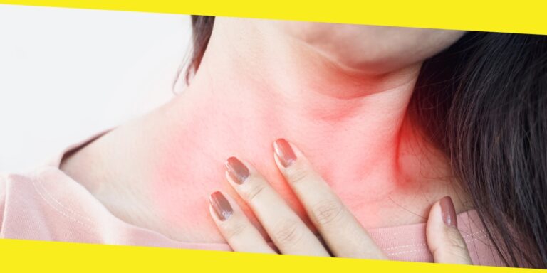 7 Tips For Reducing Acid Reflux Symptoms