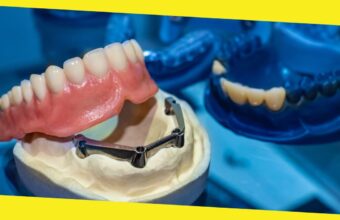 A Comprehensive Guide To Getting Your First Set of Dentures