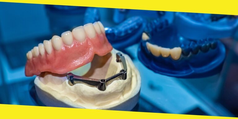 A Comprehensive Guide To Getting Your First Set of Dentures