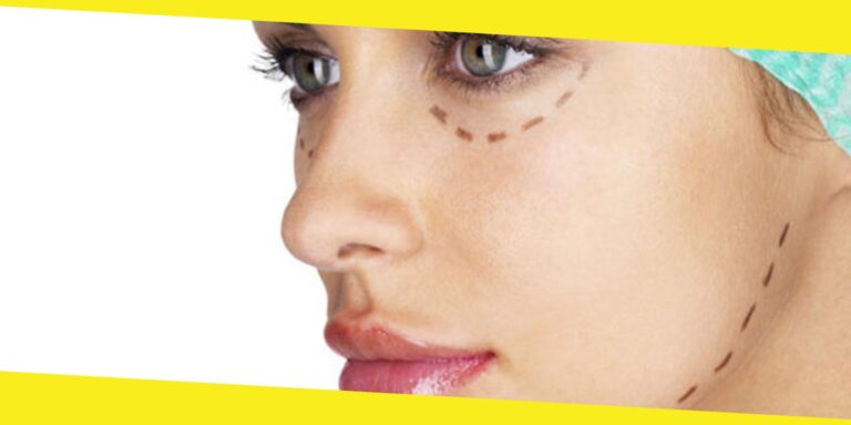 7 Benefits of Facial Implants