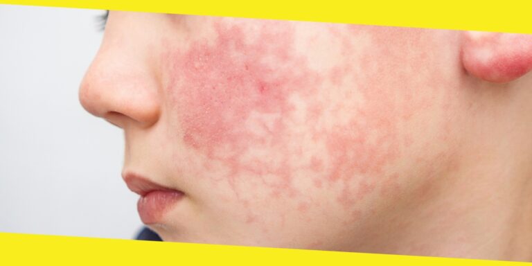 Skin Discoloration: What’s Harmless And When To See A Doctor