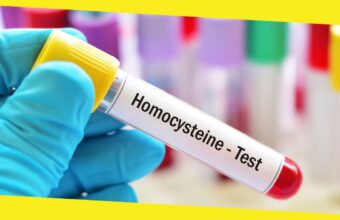 The Importance of Homocysteine Testing for Early Detection of Cardiovascular Diseases