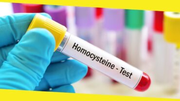 The Importance of Homocysteine Testing for Early Detection of Cardiovascular Diseases