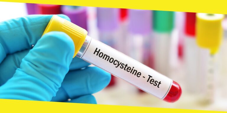 The Importance of Homocysteine Testing for Early Detection of Cardiovascular Diseases
