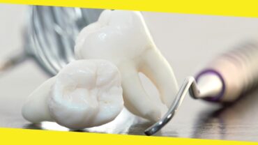 Wisdom Teeth Removal: When Is It Necessary? 