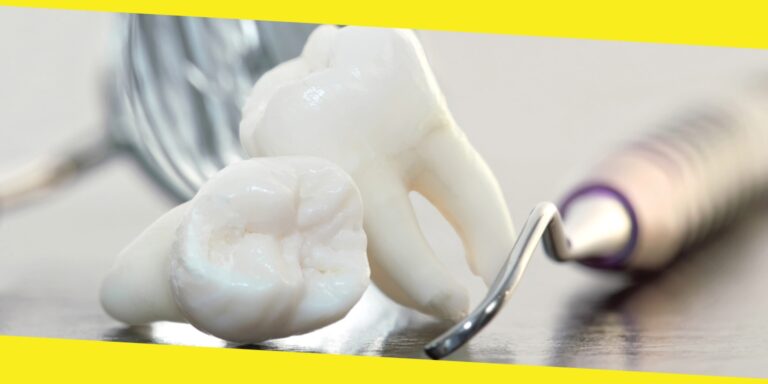 Wisdom Teeth Removal: When Is It Necessary? 