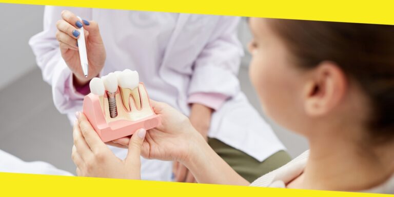 9 Signs You May Need Dental Implants In Mississauga