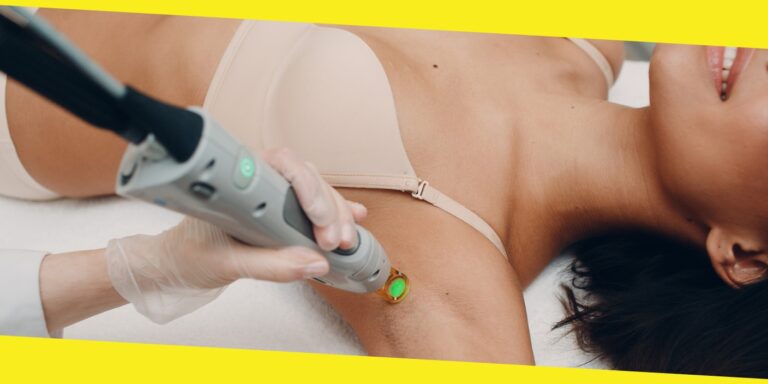 How To Prepare For Laser Hair Removal