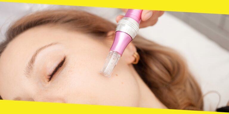 Exploring The Secrets of Microneedling