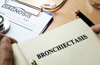 Can Bronchiectasis Worsen With Age? Insights for Seniors