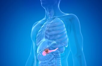 How Does an Endoscopy Clinic Play a Role in Pancreatic Cancer Treatment?