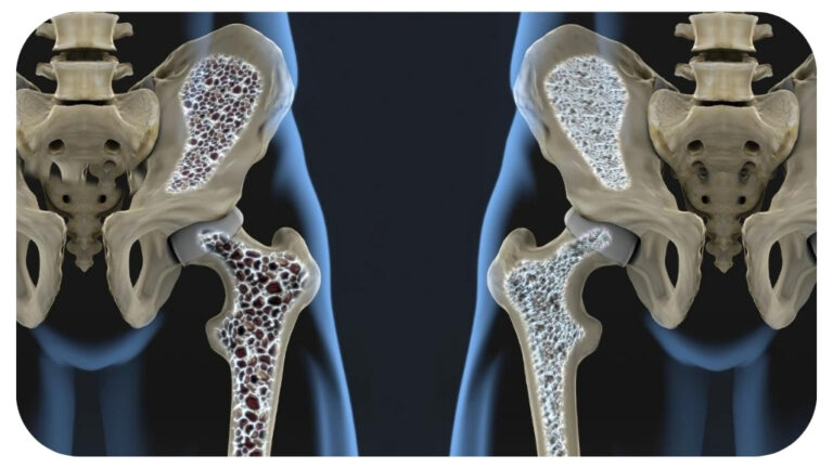 The Benefits and Risks of Testosterone Therapy for Men