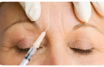 Aging Gracefully with Botox: Understanding Risks, Benefits, and Long-Term Effects