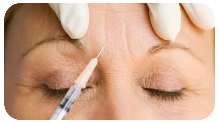 Aging Gracefully with Botox: Understanding Risks, Benefits, and Long-Term Effects