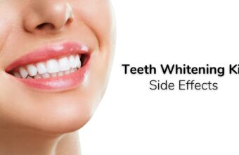 Using the Teeth Whitening Kit: Are There Any Side Effects to Take Into Account?