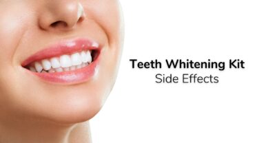 Using the Teeth Whitening Kit: Are There Any Side Effects to Take Into Account?