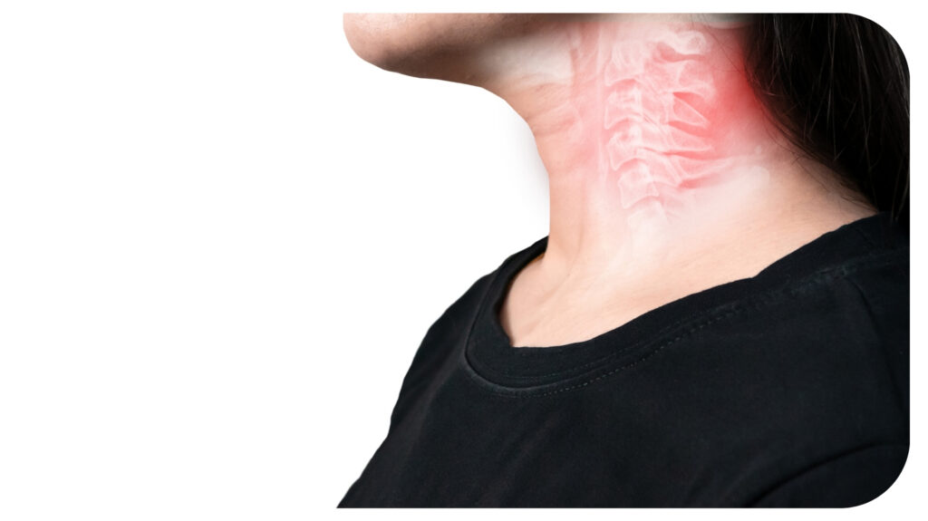 Neck bone cervical spondylosis inflammation of the cervical spine.