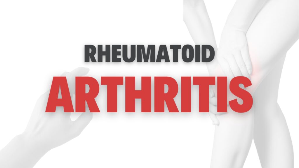 Treat Rheumatoid Arthritis