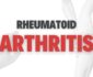 How to Treat Rheumatoid Arthritis Naturally?