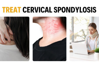 5 Effective Ways to Prevent/Treat Cervical Spondylosis