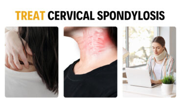 5 Effective Ways to Prevent/Treat Cervical Spondylosis