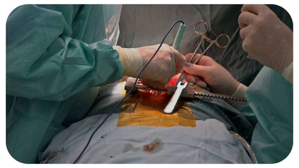 Suture of an lung emphysema surgery in an infant andmedical assistance close-up.