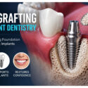 The Role Of Bone Grafting In Successful Implant Dentistry The Role Of Bone Grafting In Successful Implant Dentistry
