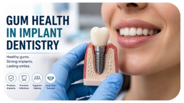The Role Of Gum Health In Successful Implant Dentistry The Role Of Gum Health In Successful Implant Dentistry