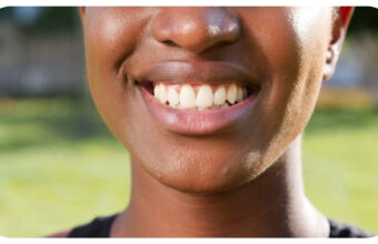 Signs That You Would Benefit From Dental Implants