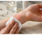 Treating Contact Dermatitis: Pro Tips for Rapid Relief