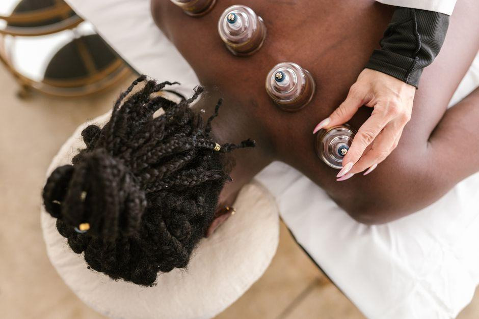 Therapist applying suction cups to a woman's back during a cupping therapy session as part of a holistic approach to muscle recovery and wellness.